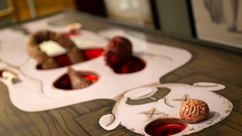 Terrible Tales Exhibit Grisly operation 965x540
